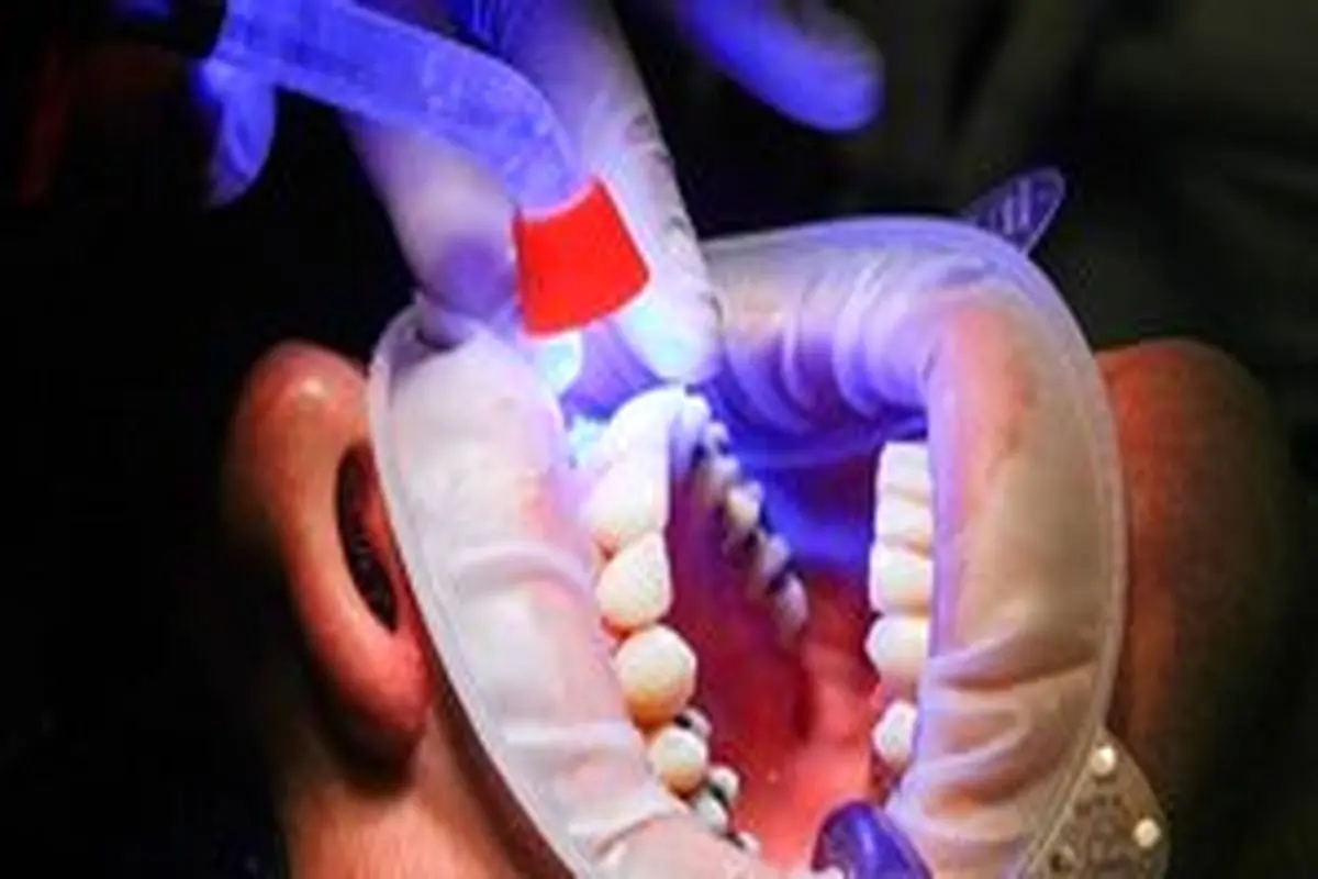 رشد عجیب دندان در بینی مرد ۳۰ ساله + عکس