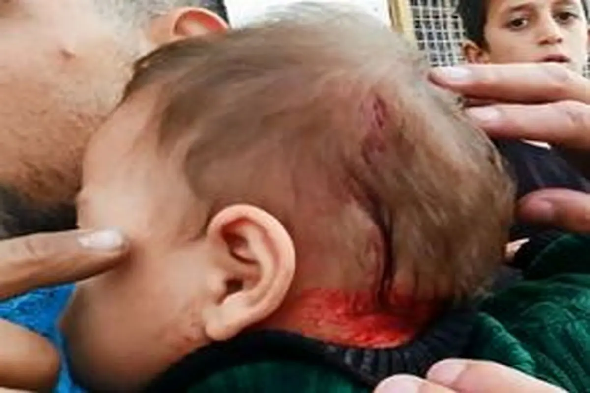 زخمی شدن نوزاد فلسطینی در یورش شهرک‌نشینان به الخلیل