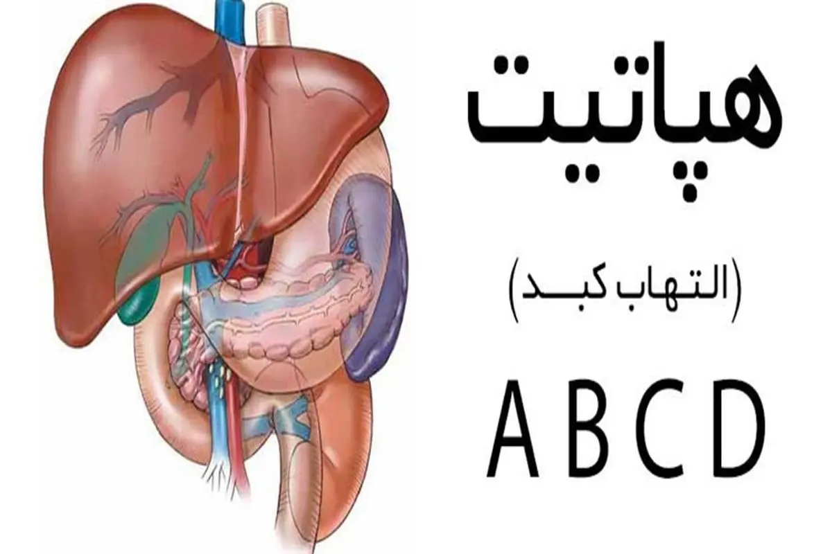 «هپاتیت» بیماری خاموش/ بیاطلاعی ۸۵ درصد بیماران از هپاتیت