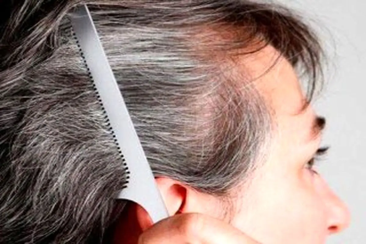 دو عامل موثر در سفید شدن مو‌ها