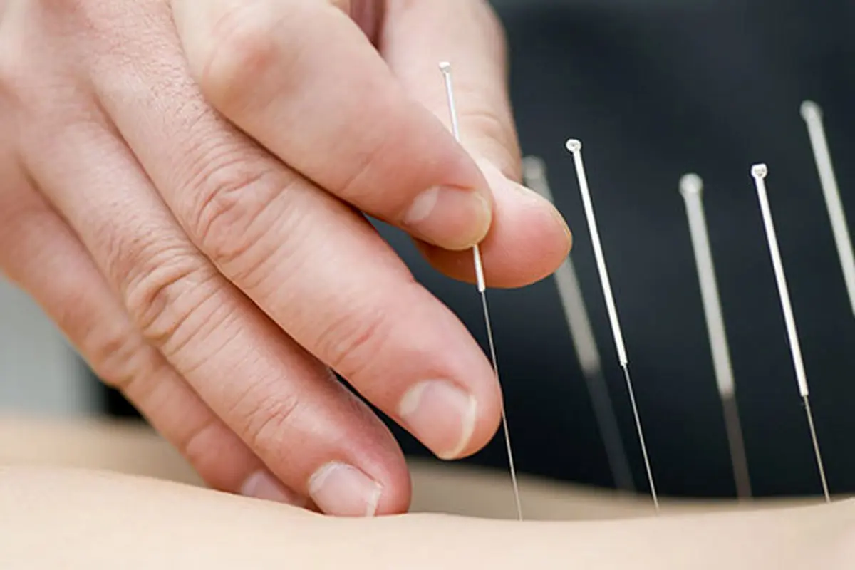 طب سنتی و خداحافظی با دردهای مفصلی