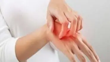 ۱۰ دلیل خارش شدید پوست