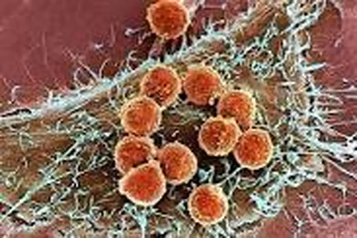 سلول‌های سرطانی چگونه ریشه می‌کنند؟