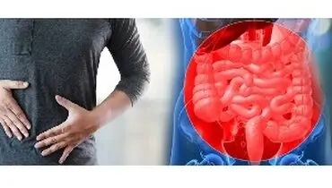 خونریزی دستگاه گوارش چه علائمی دارد؟ درمان خونریزی دستگاه گوارش