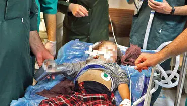 چرخ گوشت انگشتان کودک مشهدی را بلعید