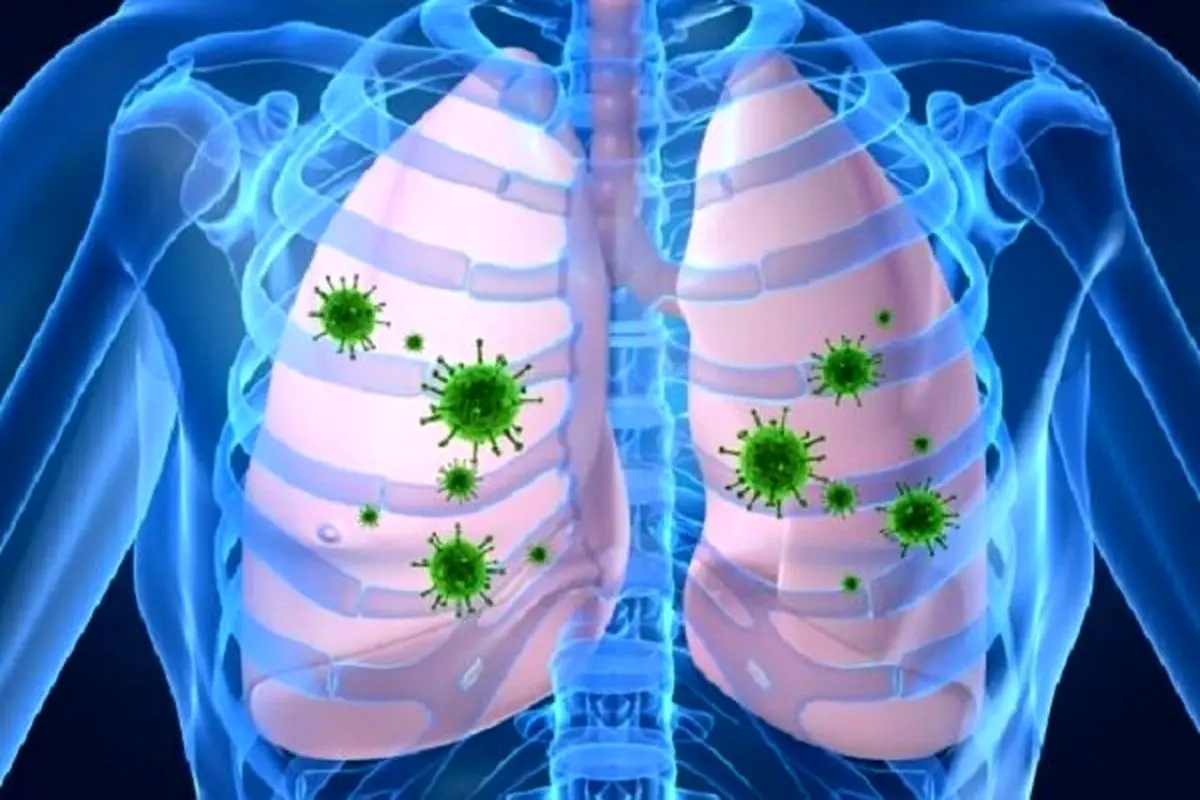 تاثیر تغییرات اقلیمی در افزایش شیوع عفونت‌های تنفسی