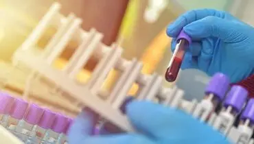زنگ خطری برای شروع آلزایمر