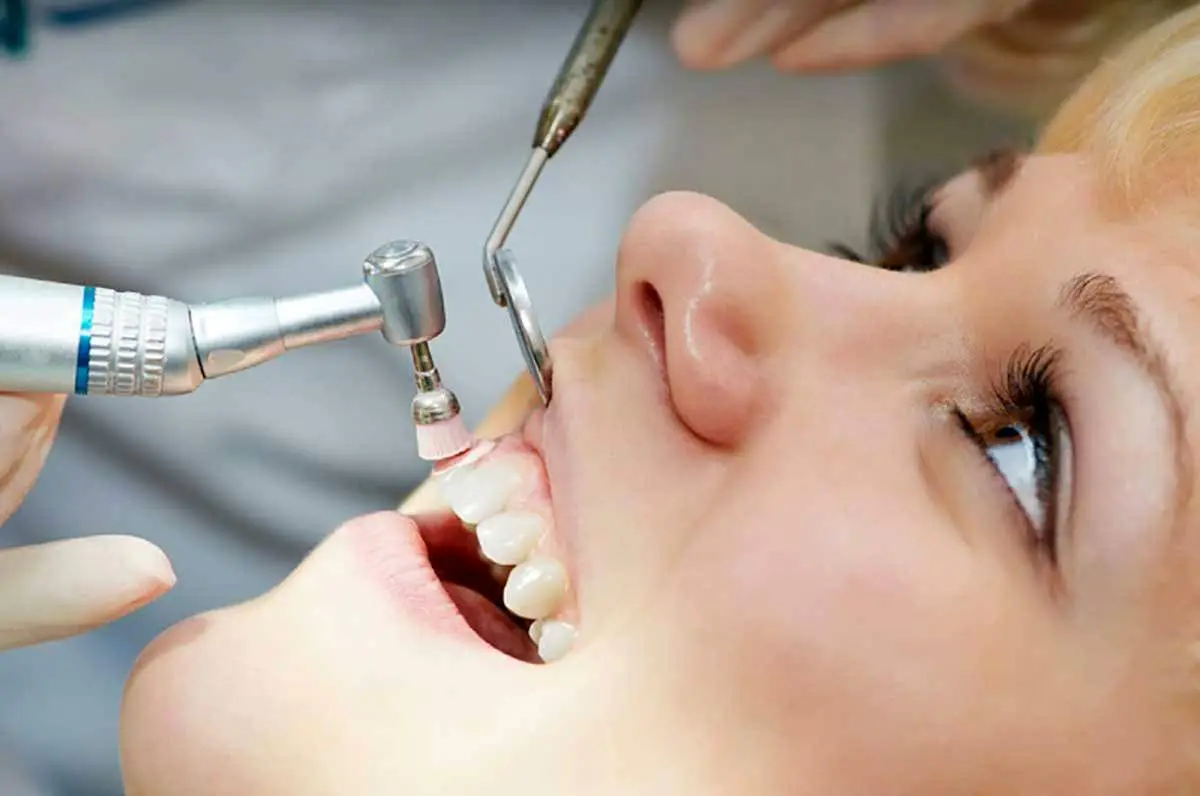 آیا جرم گیری، دندانهایتان را لق می‌کند؟