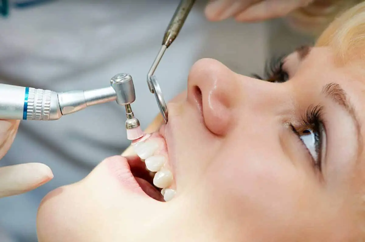 آیا جرم گیری، دندانهایتان را لق می‌کند؟