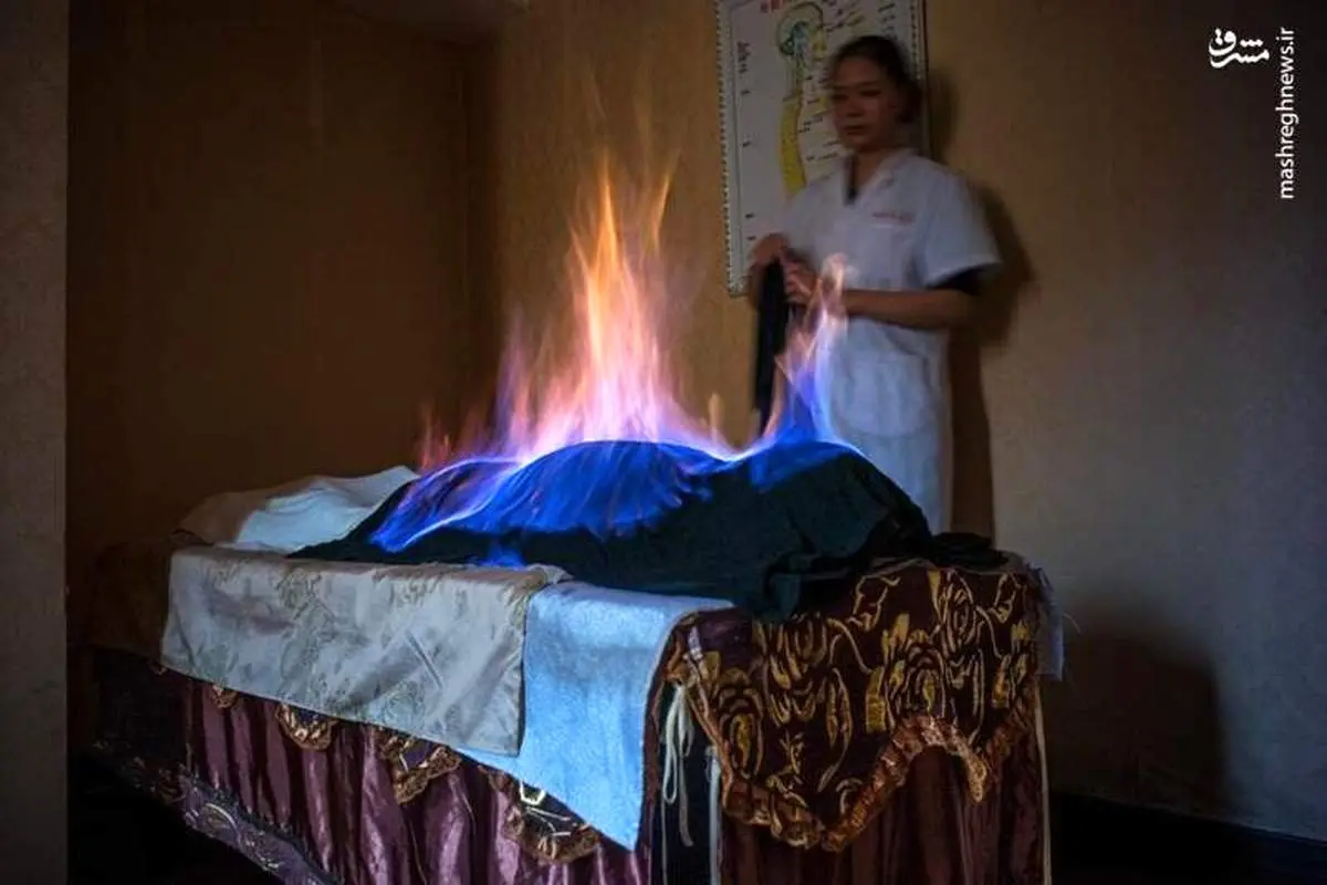 تصویری عجیب از جلسه آتشدرمانی