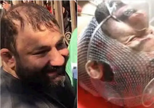 اولین تصویر از چهره غرق در خون هانی کرده و ضارب+ عکس