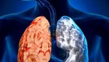 پیامد‌های آلودگی هوا برای بیماران مزمن تنفسی