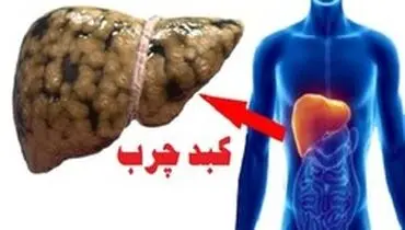 چه غذایی بخوریم کبدمان چرب نشود؟