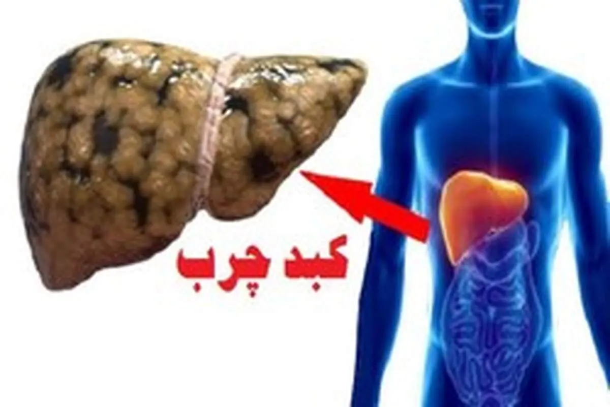 چه غذایی بخوریم کبدمان چرب نشود؟