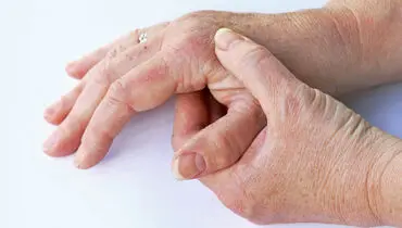 آرتروز چگونه ایجاد می‌شود؟