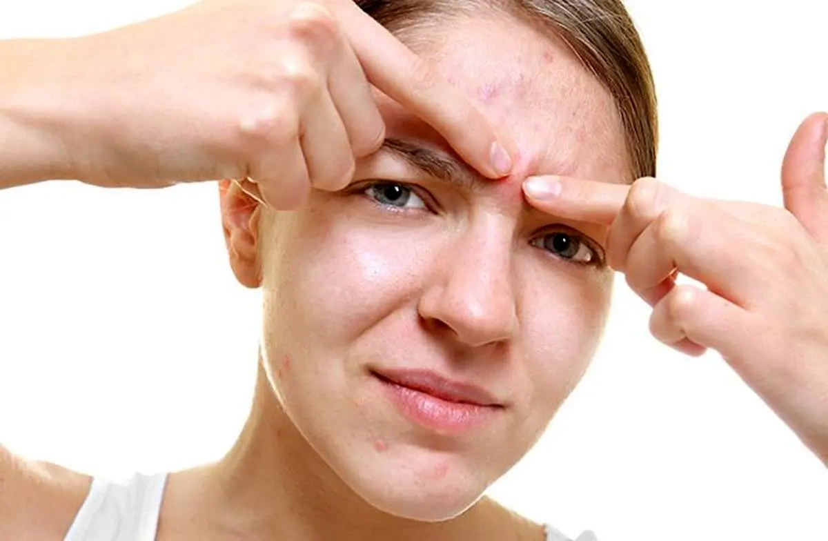 ترکاندن کدام جوشها خطرناک است؟