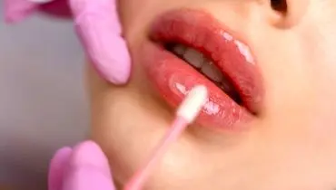 مراقبت های بعد از ژل لب