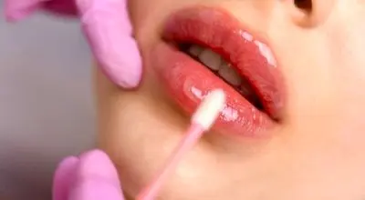 مراقبت های بعد از ژل لب