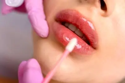 مراقبت های بعد از ژل لب