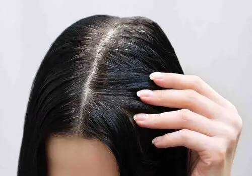 یائسگی بدون اضافه‌وزن با دو مکمل