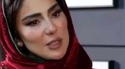 بازیگر بامداد خمار: مجبور شدم کامپوزیت‌های دندانم را بردارم/ویدیو 