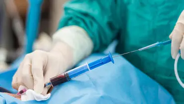 آنژیوگرافی و دانستنی‌هایی درباره آن