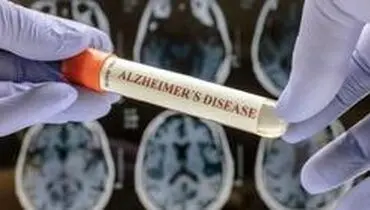 برای مبارزه با آلزایمر کولین مصرف کنید