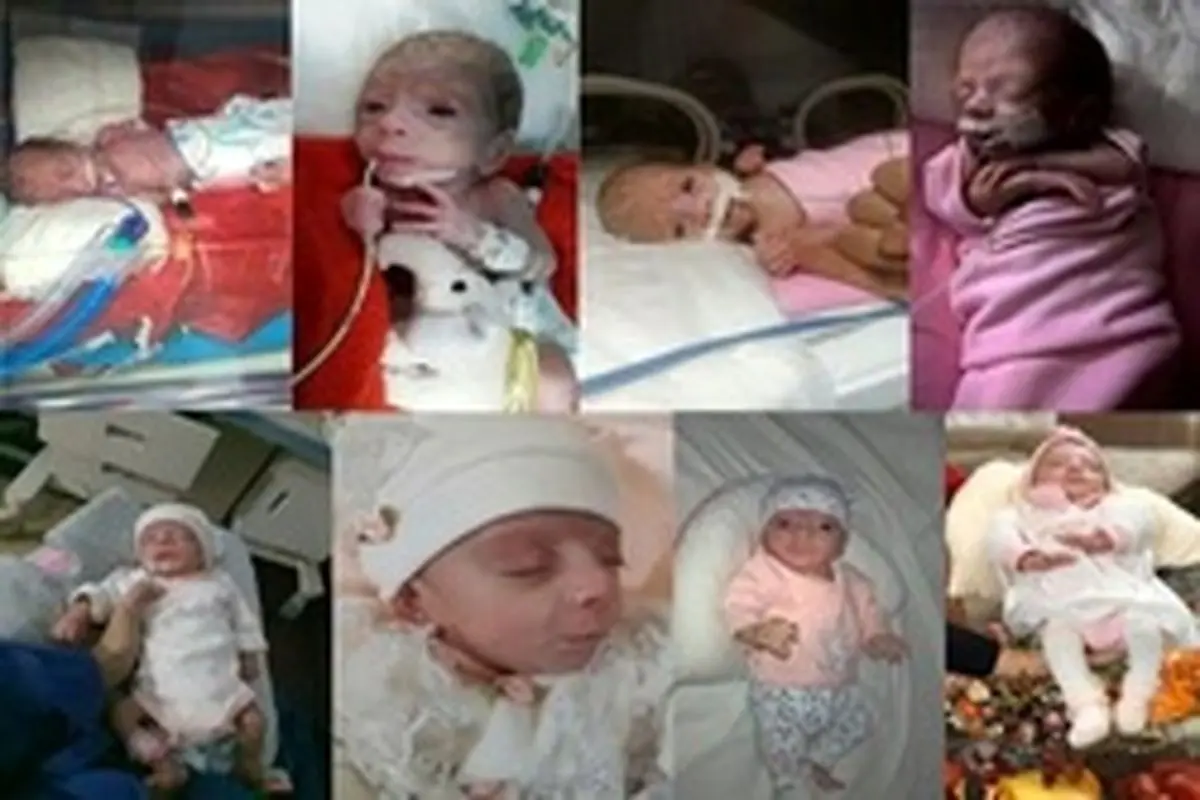 ماجرای تولد نوزاد نیم کیلویی در قم +عکس