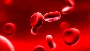 ترفندهای درمانی کم خونی+علائم ظاهری