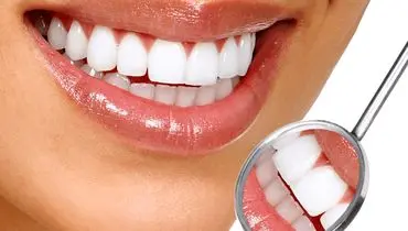 بدرنگ شدن دندان‌ها به چه علت است؟