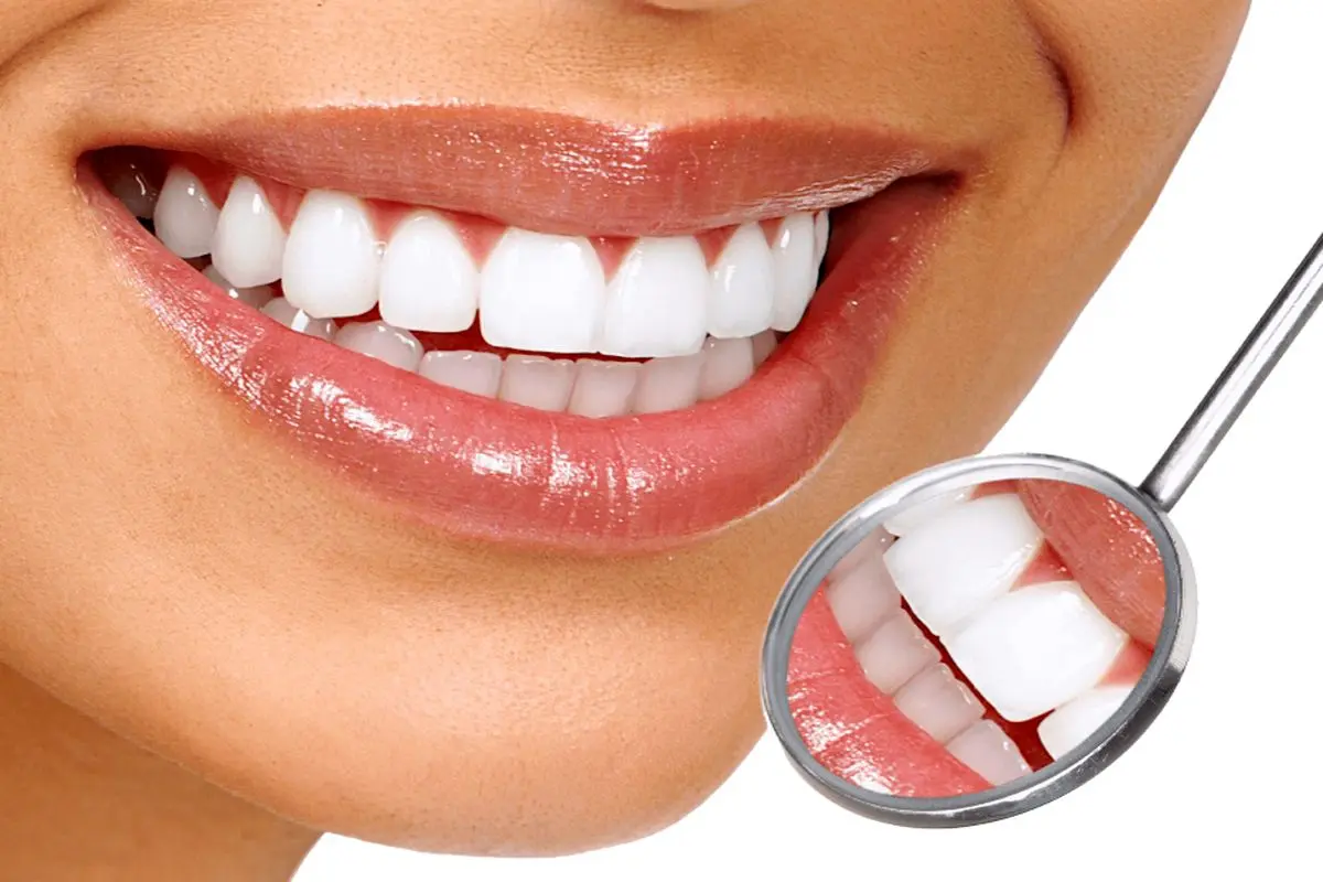 بدرنگ شدن دندان‌ها به چه علت است؟