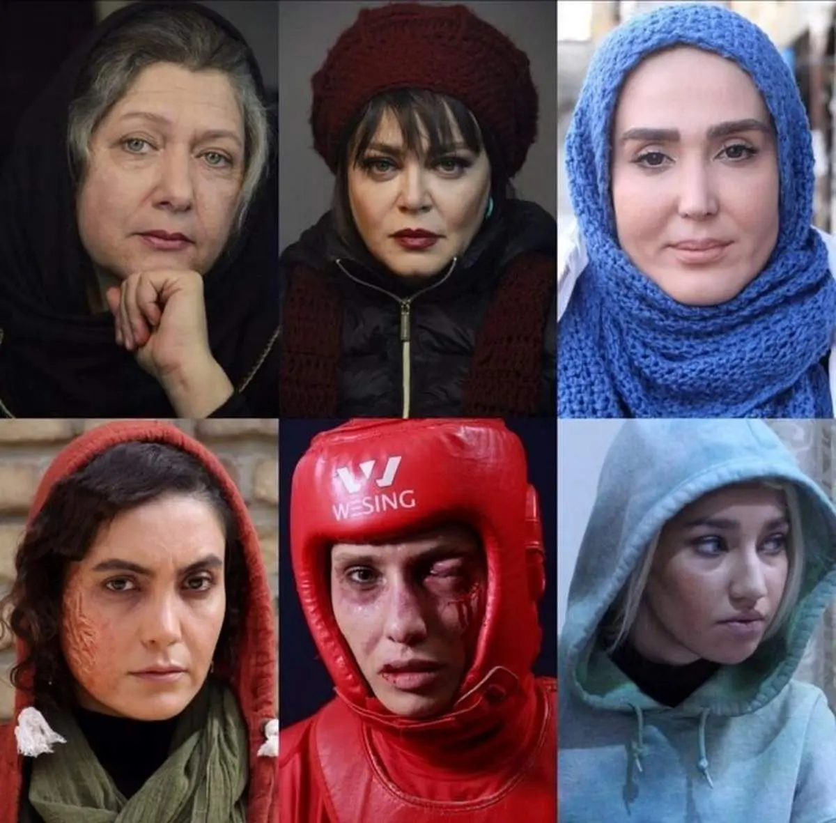 صورتهای زخمی بازیگران یک فیلم کاملا زنانه