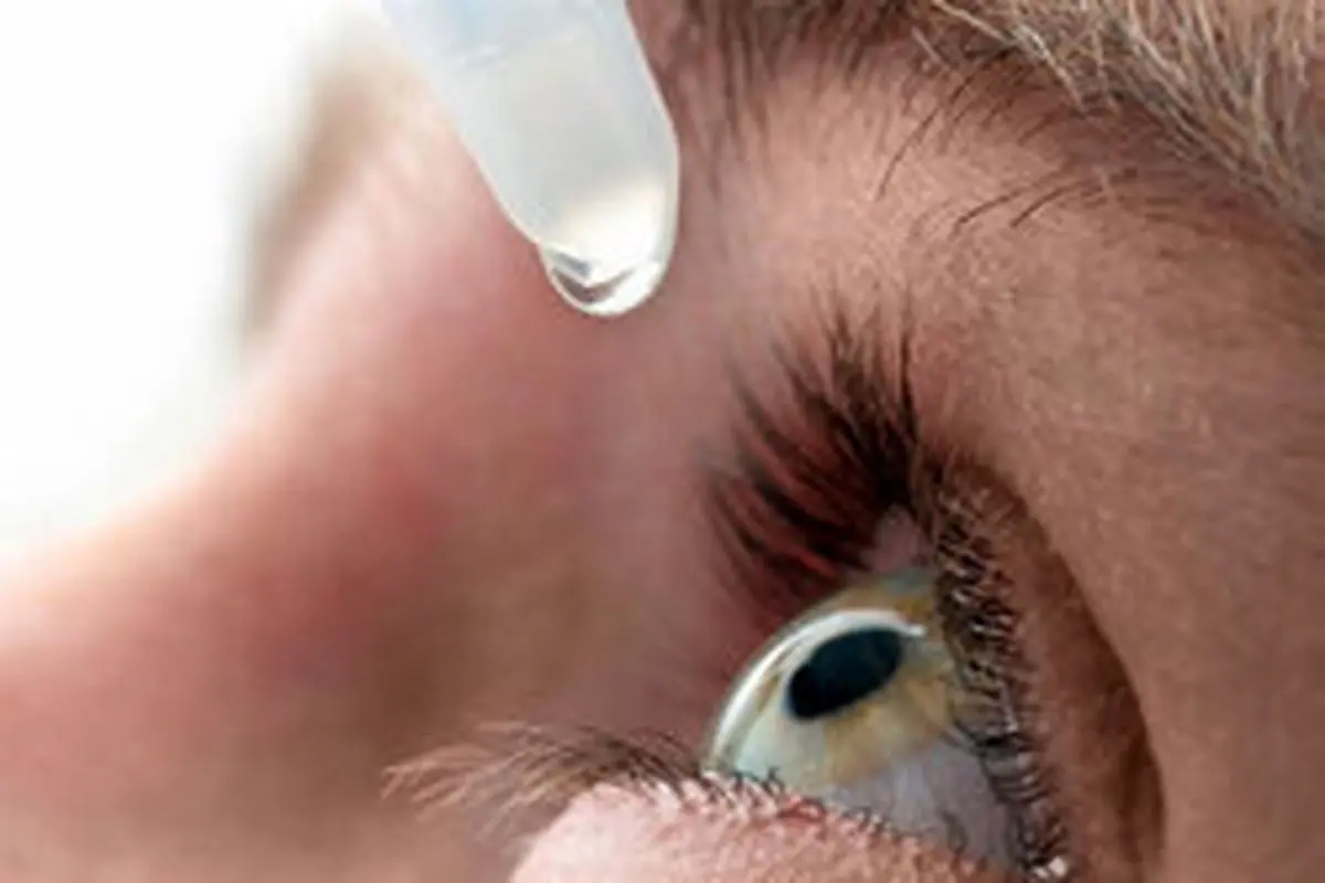 آلرژی چشم و راه‌های درمان آن