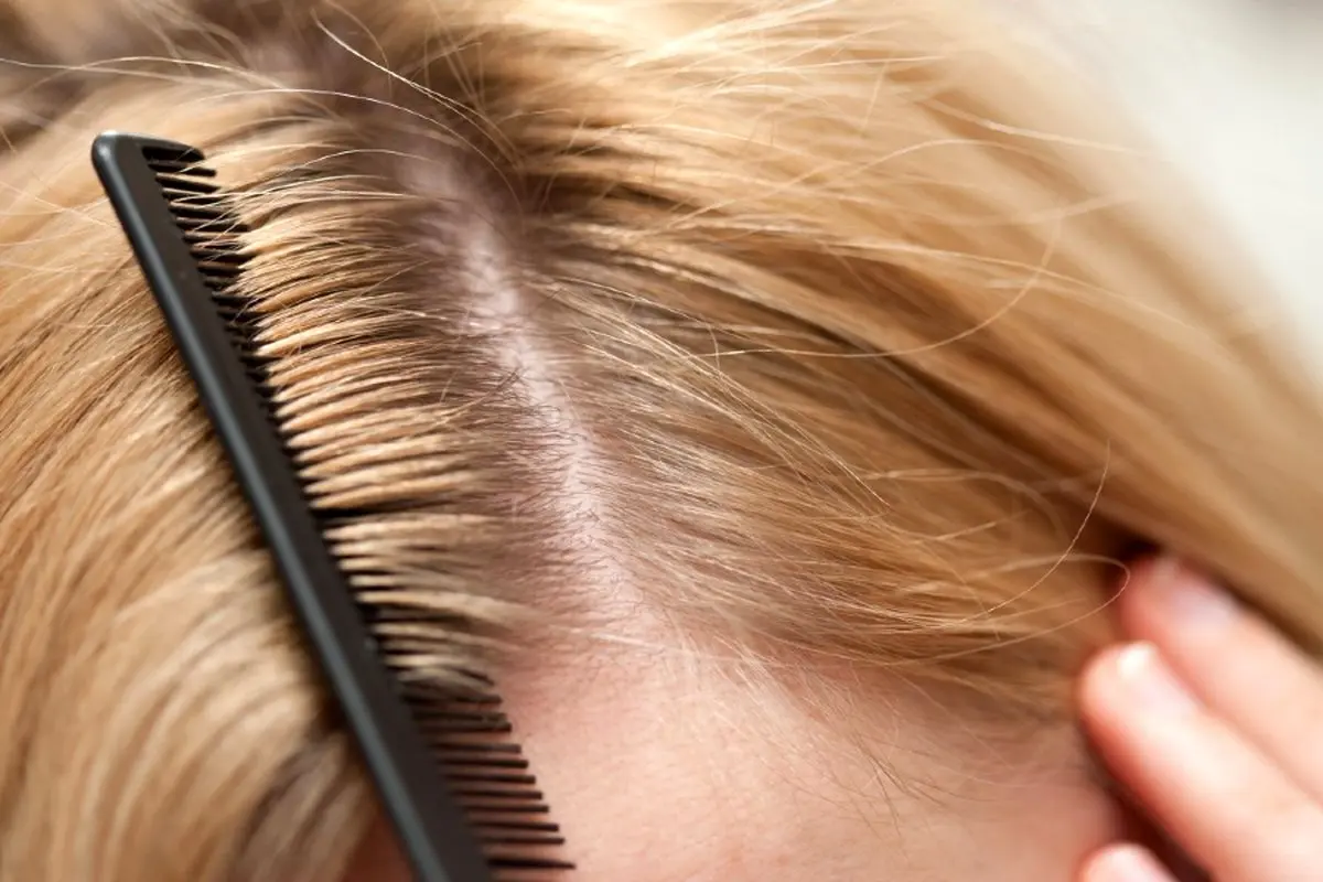 چهار روش برای استحکام ریشه مو