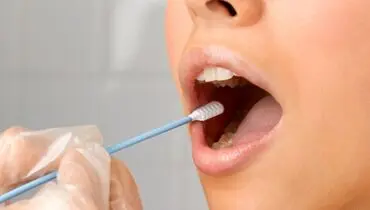 غدد بزاقی چه نقشی در بدن دارند