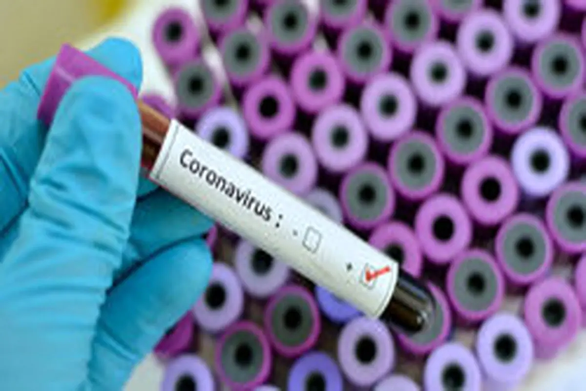 تشخیص "کروناویروس" در کمتر از ۱۵ دقیقه