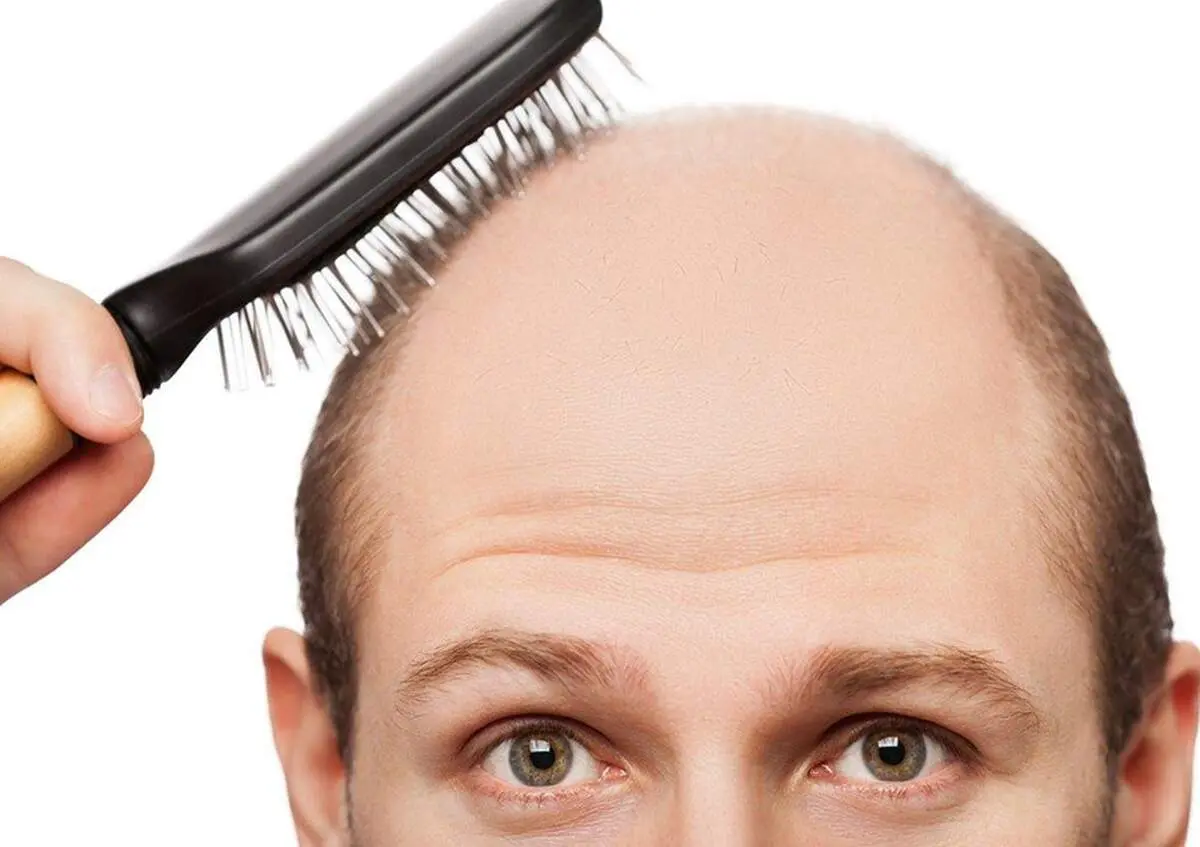 برای جلوگیری از ریزش مو این ۱۱ نکته فراموش نشود