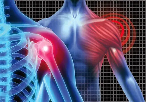 توصیه کارشناسان برای پیشگیری از آسیب تاندون‌ها
