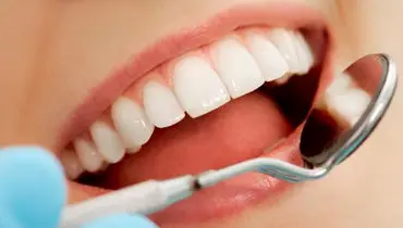 ۸ اشتباه رایج که دندان‌های ما را به تدریج نابود می‌کنند
