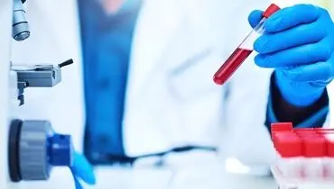 شایع‌ترین دلیل نابینایی کشف شد
