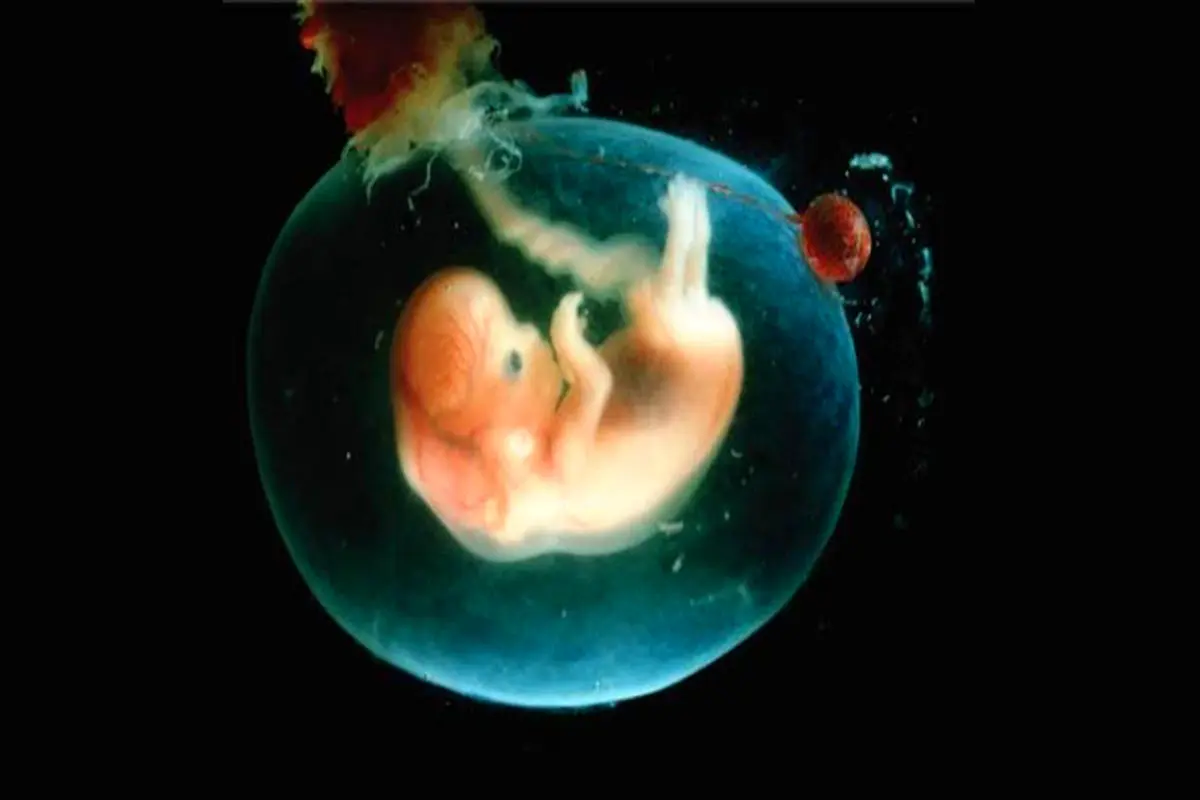 عوارض کم شدن مایع آمنیوتیک بر رشد جنین