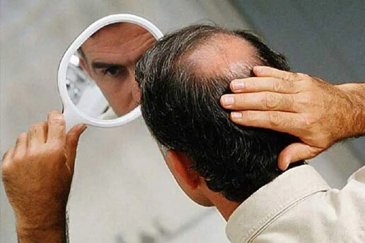 جوشانده ضد ریزش و رویش مجدد مو