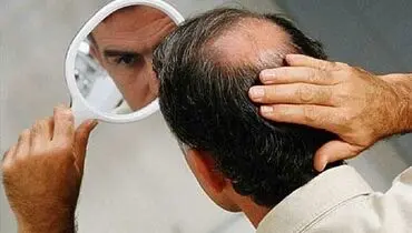 جوشانده ضد ریزش و رویش مجدد مو