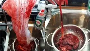 این مردی جفت جنین همسرش را خورد