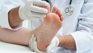 هر آنچه درباره زگیل‌ها باید بدانید