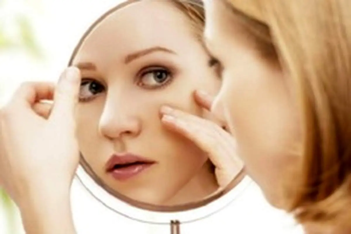 اگر پوست نازکی دارید این بیماری در کمین شماست