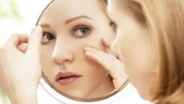 اگر پوست نازکی دارید این بیماری در کمین شماست