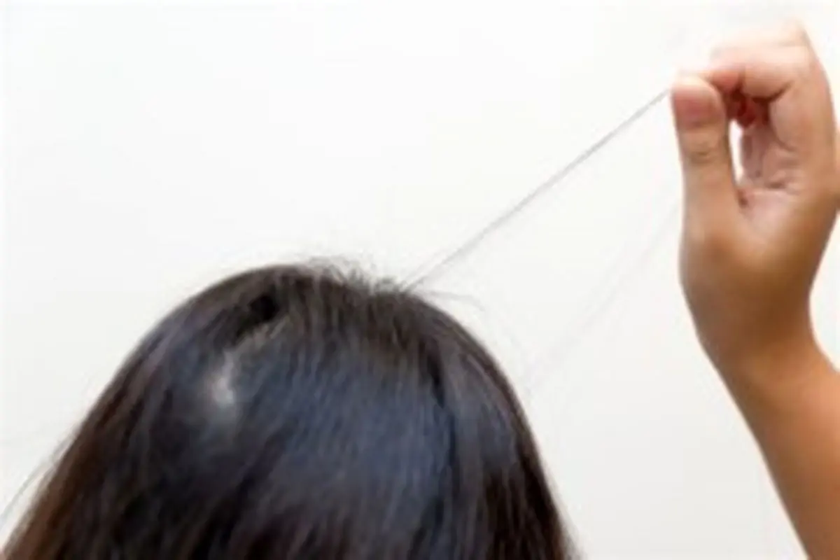 از علت تا درمان مبتلا به وسواس کندن مو