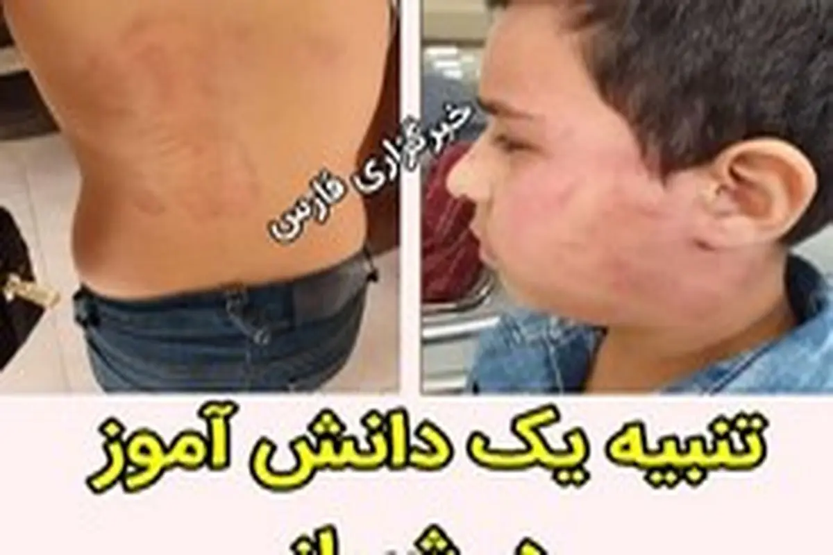 تنبیه بدنی یک دانش‌آموز پسر در شیراز