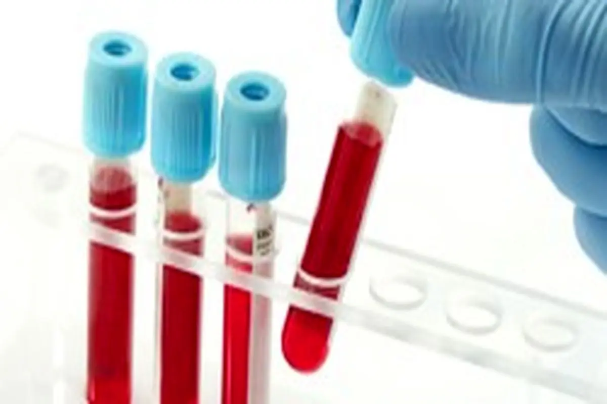نقش خون و فرآورده‌های خونی در بهبود سرطان‌ها